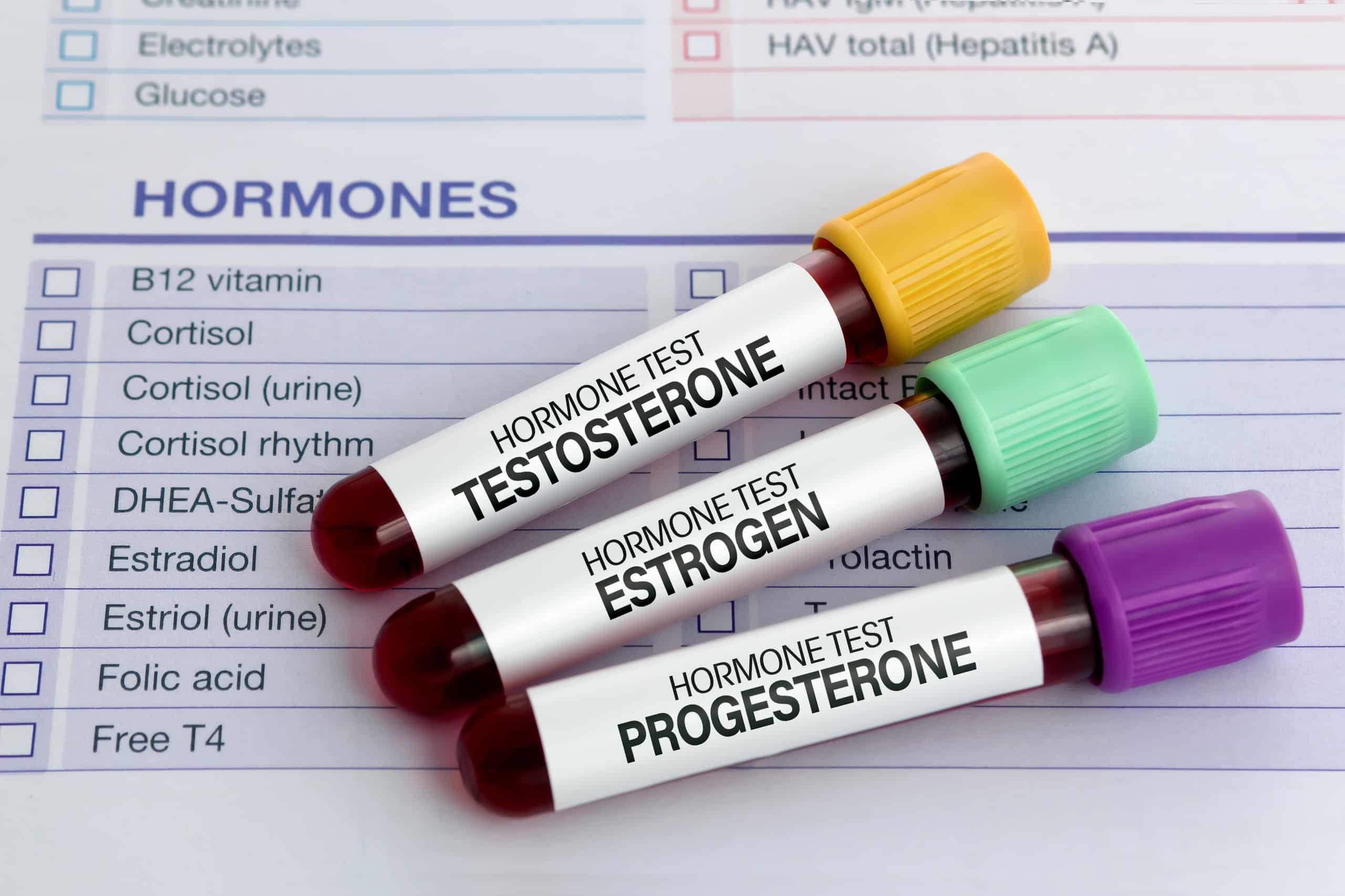 Three blood sample vials labeled "Testosterone," "Estrogen," and "Progesterone" placed on a medical report titled "Hormones." The vials have colored caps: yellow for Testosterone, green for Estrogen, and purple for Progesterone.