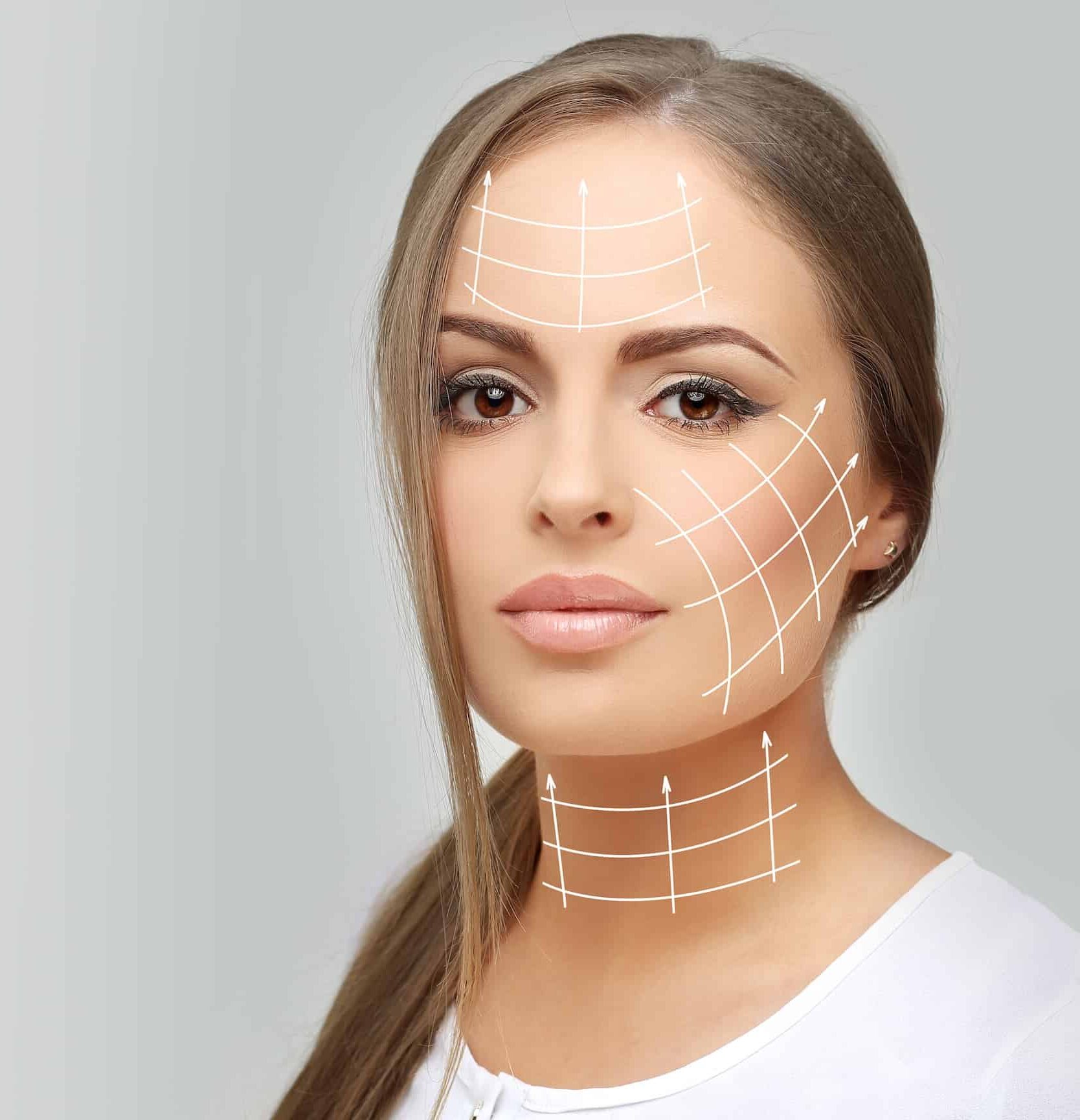 A woman with medium-length brown hair, wearing a white top, gazes directly at the camera. Over her face, there are white grid lines indicating facial areas, commonly used in cosmetic procedures, on a neutral gray background.