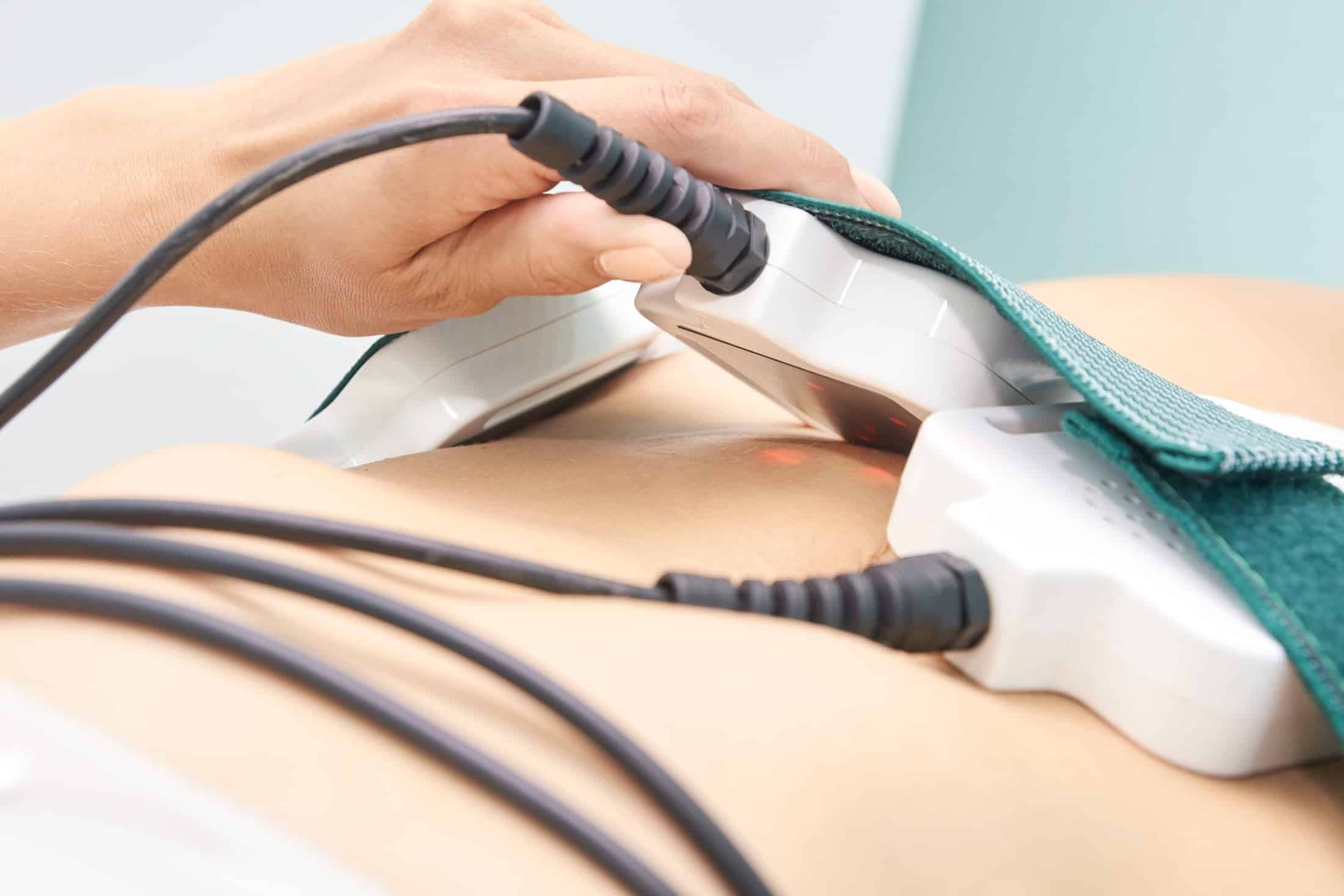 A close-up of a hand operating a medical device on a patient's abdomen, with wires connected to the device and a focused light on the skin.