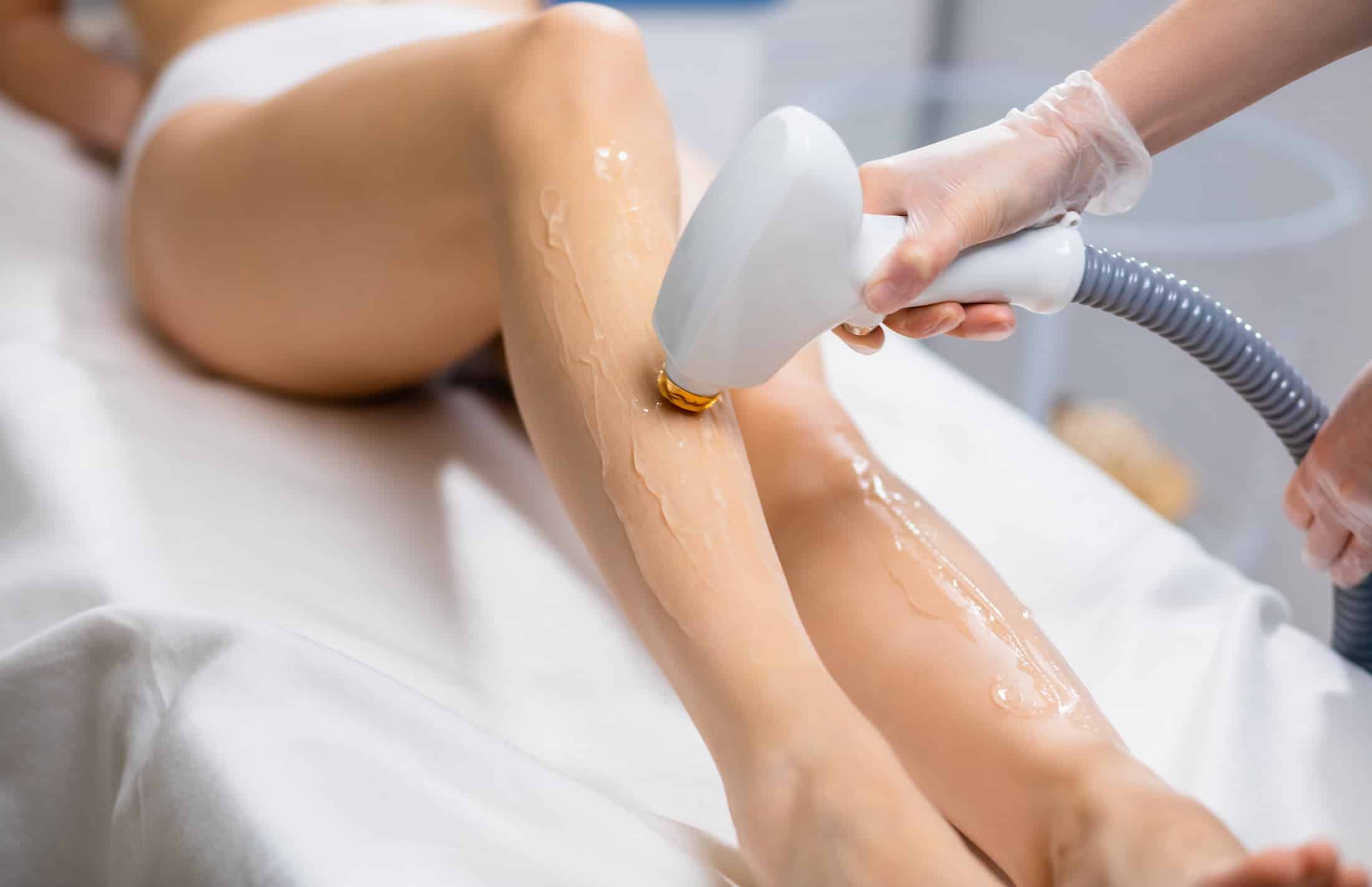 A person receiving a laser hair removal treatment on their leg, with a technician holding a handheld device. The leg is coated with a gel, and a white treatment table is visible in the background.