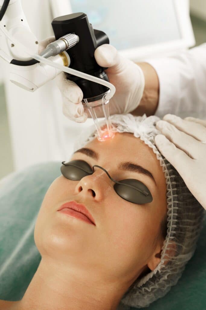 A woman receiving a laser treatment on her face while wearing protective goggles, with a technician using a handheld laser device in a clinical setting.