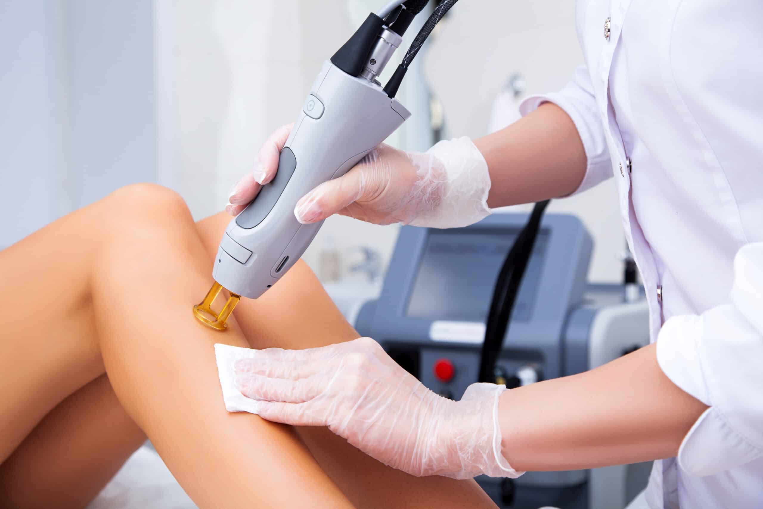 A healthcare professional in a white coat using a laser device on a patient's leg during a cosmetic procedure. The technician is applying a pad on the skin while the laser device is in operation, with a modern medical machine visible in the background.